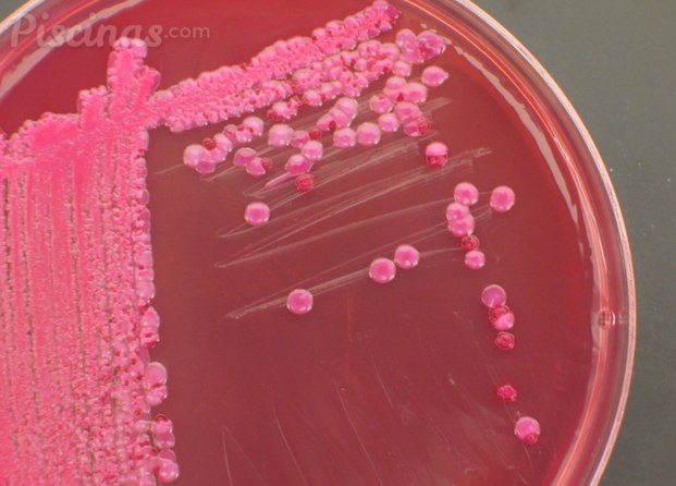 Coliformes - E coli. 